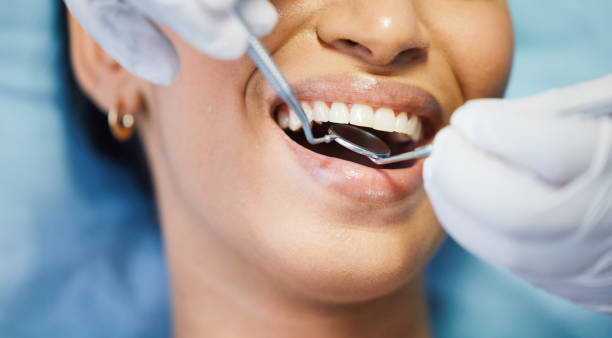 Best Emergency Dental Care for Sports Injuries in Syracuse, UT