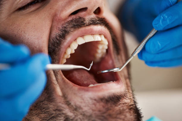 Best Emergency Treatment for Oral Infections in Syracuse, UT