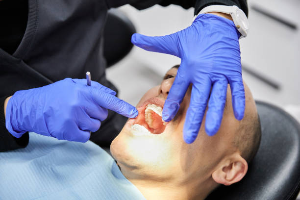 Best Emergency Care for Gum Disease in Syracuse, UT